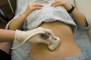 ecografie gravidanza